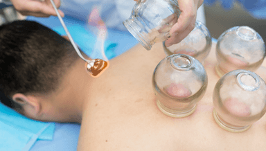 Image for Fire Cupping Initial Consult