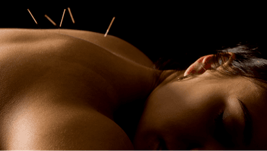 Image for Acupuncture (Subsequent Visit) with Paul