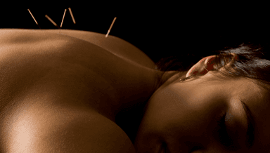 Image for Initial Acupuncture Consultation with Scosha